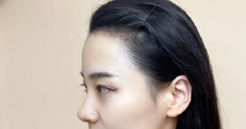 女性額頭寬大發(fā)際線(xiàn)高面相好不好？