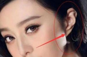 沒(méi)有耳垂的人命運(yùn)怎么樣